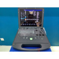 Scanner d&#39;ultrason portatif de prix de machine d&#39;ultrason de Doppler de couleur de Digital complet